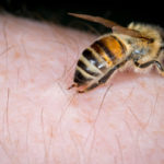 Bee on person's skin