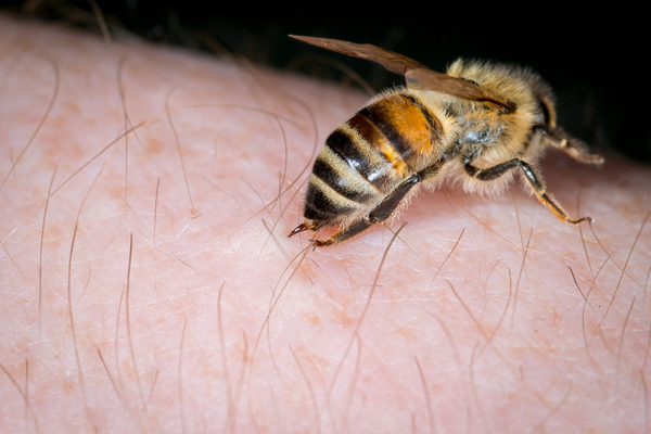 Bee on person's skin