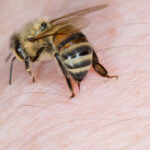 bee stings in Kalamazoo MI | Griffin Pest Solutions